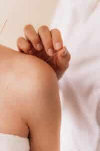Beneficios de la acupuntura